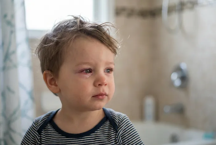 Parfum dans les yeux enfant : urgence - Guide ultime : 3 gestes - Parfum dans les yeux : que faire vite ? Gros plan d'un enfant avec un œil irrité par du parfum.